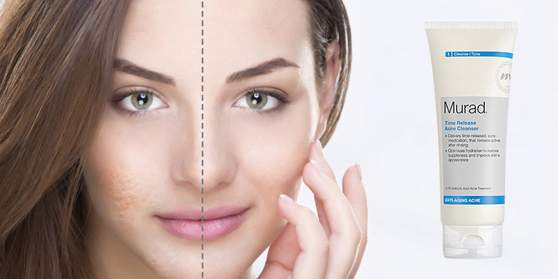 Sửa rửa mặt trị mụn Time Release Acne Cleanser