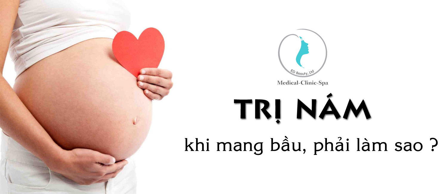 trị nám da khi có thai