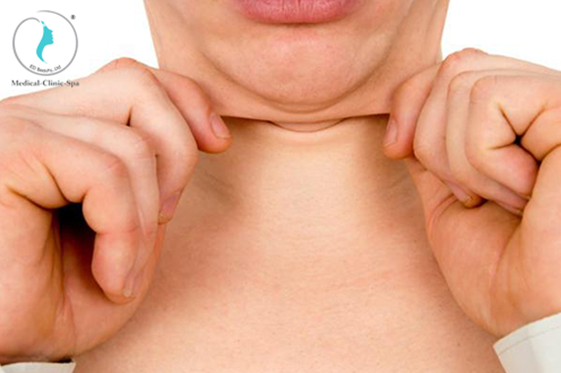 Công nghệ Thermage đánh tan nọng cằm hiệu quả không?