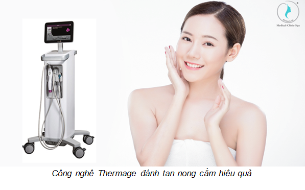 Công nghệ Thermage đánh tan nọng cằm hiệu quả