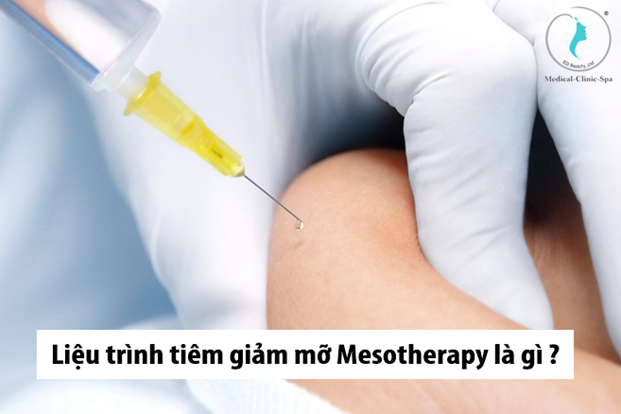 Liệu trình tiêm giảm mỡ Mesotherapy là gì