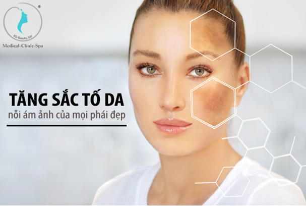 Hình. Tình trạng tăng sắc tố da nỗi ám ảnh của mọi phái đẹp