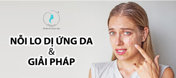 Hình. Nỗi lo dị ứng da mặt và giải pháp