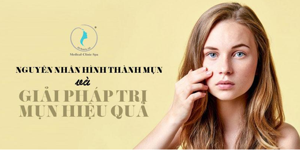 Nguyên nhân hình thành mụn và giải pháp trị mụn hiệu quả