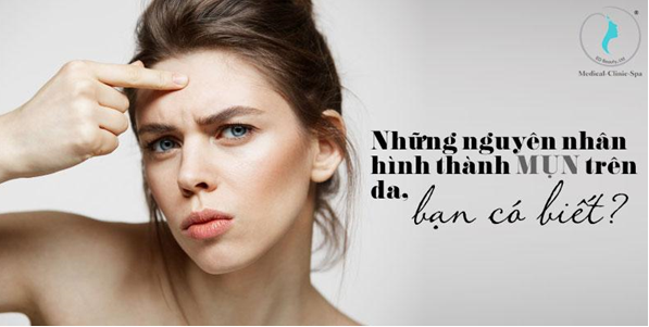 Những nguyên nhân hình thành mụn trên da, bạn có biết?