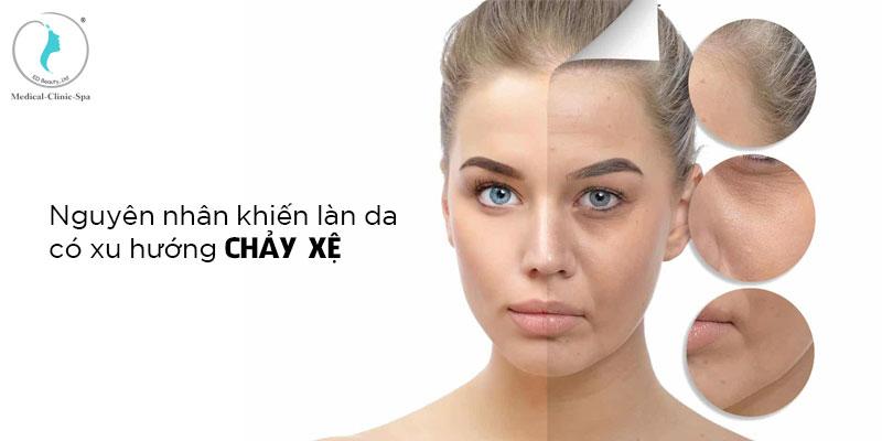 Nguyên nhân khiến làn da có xu hướng chảy xệ