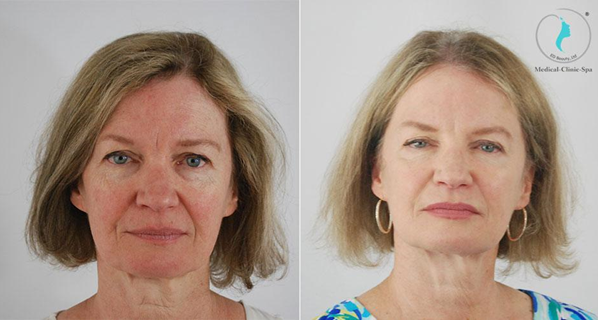 Tầm quan trọng của việc chăm sóc da với serum