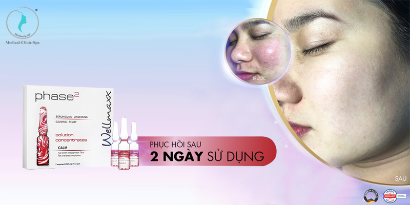 Công dụng của huyết thanh Wellmaxx Solution Concentrate CALM