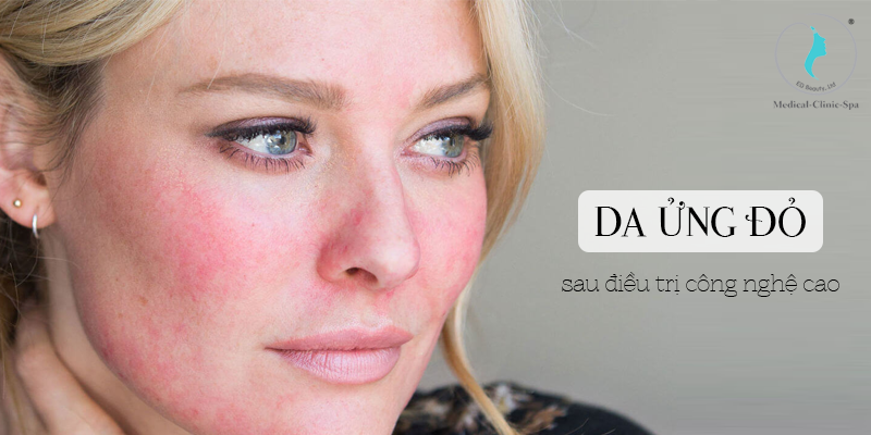 BẬT MÍ LÝ DO NÊN DÙNG THỬ WELLMAXX SOLUTION CONCENTRATE CALM