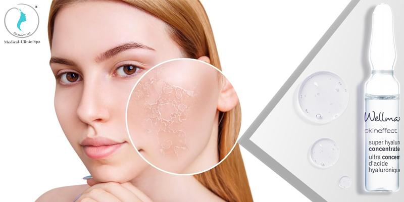 Skin Effect Super Hyaluron giúp cải thiện làn da khô ráp chỉ sau 1 đêm