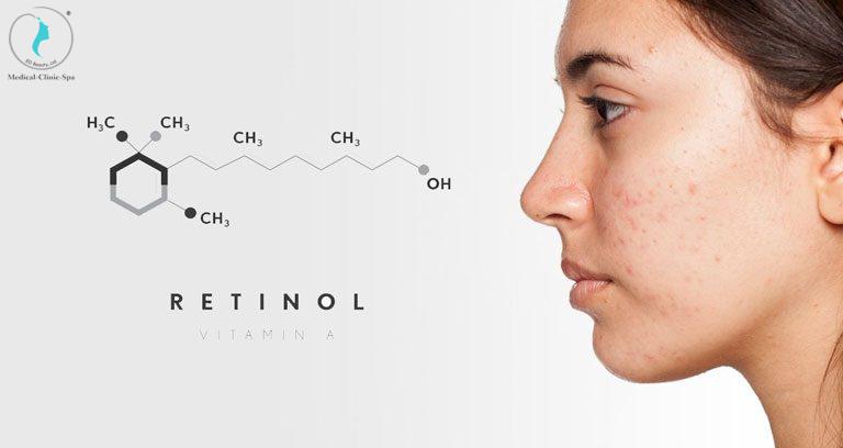 Hoạt chất Retinol trong điều trị mụn