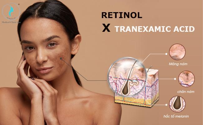 Các thành phần đặc biệt trong ba sản phẩm Fusion & Ekseption