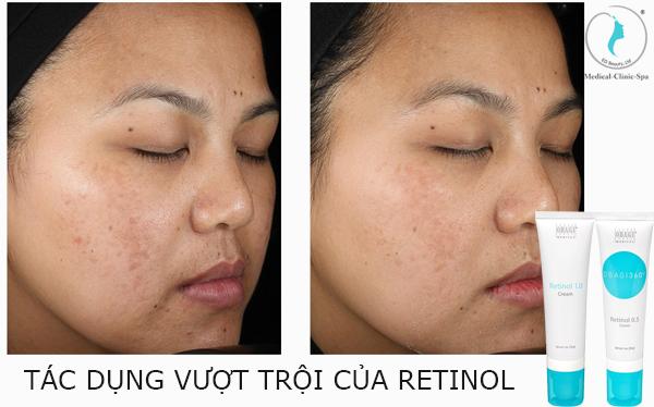 Tác dụng vượt trội của Retinol?