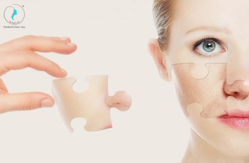 Xu hướng peel trong điều trị các vấn đề da
