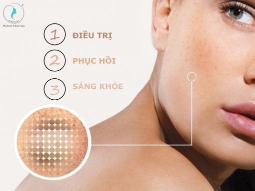 Tiêu chí của 3 bước điều trị nám da, dưỡng sáng da là điều trị - phục hồi - sáng khỏe