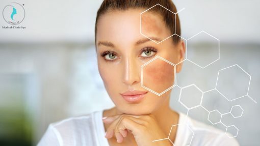 Da sạm nám khiến các chị em mất đi sự tự tin vốn có