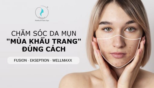 Da mụn “mùa khẩu trang” đúng cách với Fusion - Ekseption - Wellmaxx