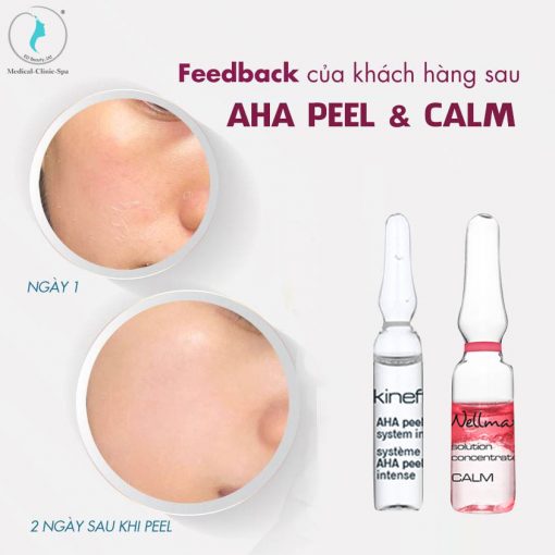 Peel da thế hệ mới cùng Wellmaxx AHA Peel và huyết thanh CALM