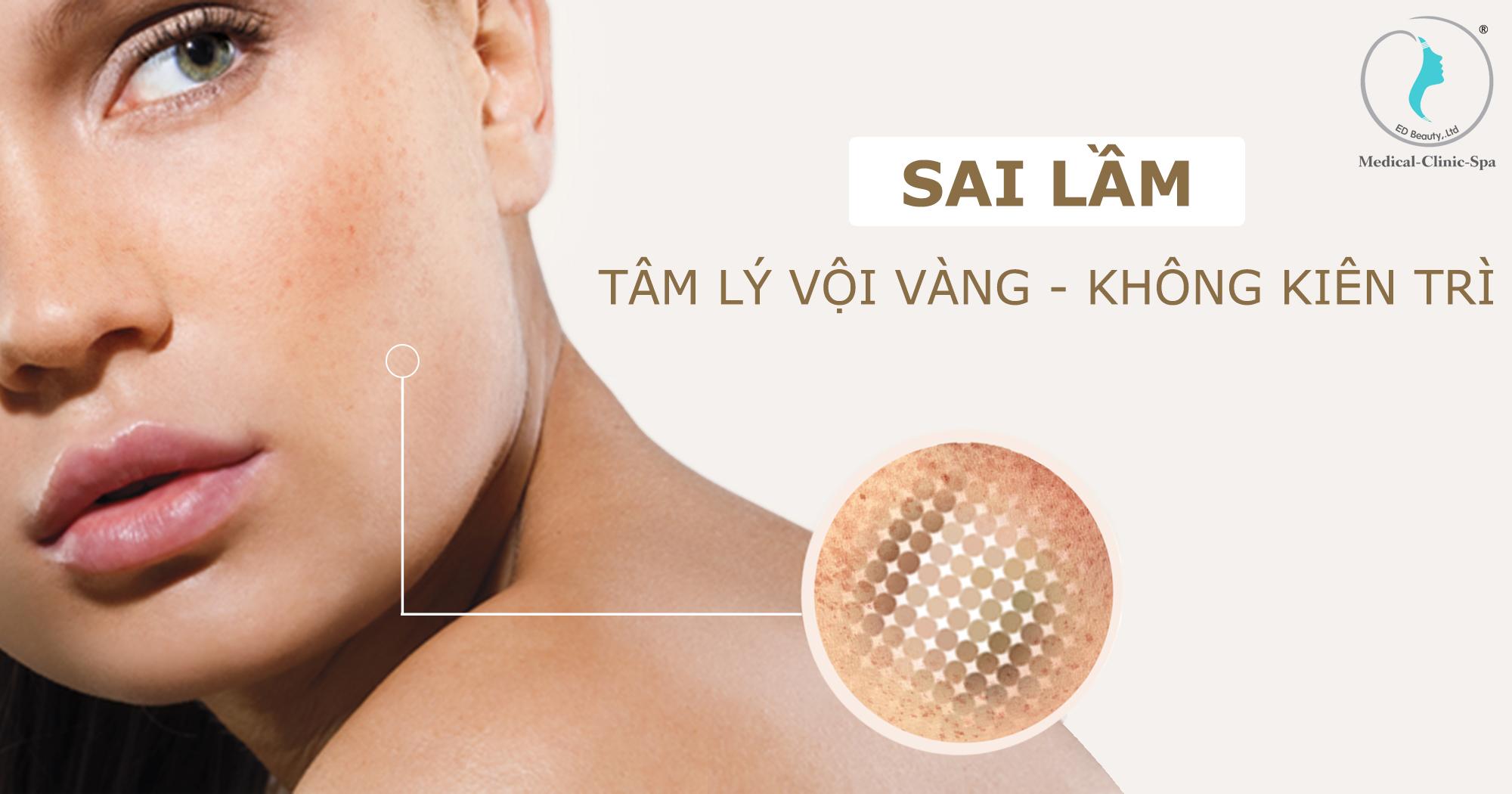 Sai lầm khi điều trị nám tại nhà là tâm lý vội vàng và không kiên trì