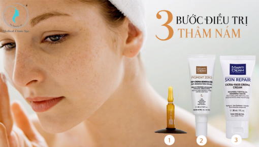 Quy trình 3 bước điều trị thâm nám cùng sản phẩm Martiderm