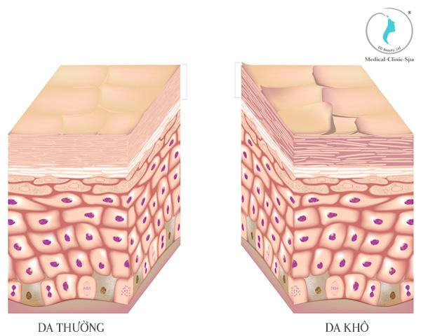 Da mùa hanh khô phải đối mặt với vấn đề gì?