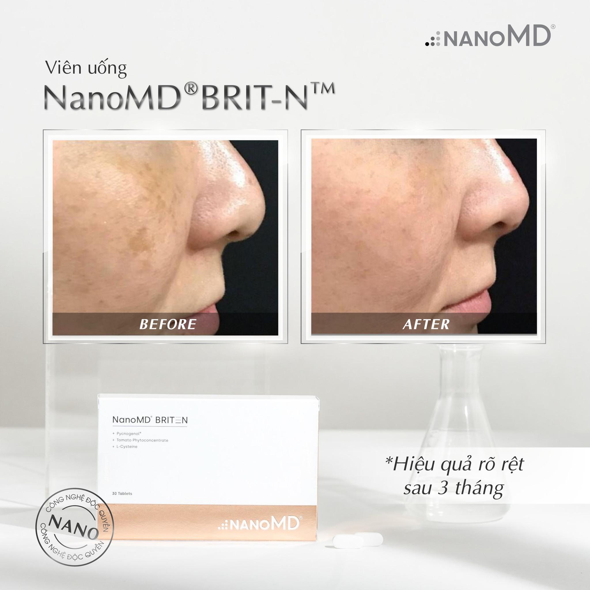 Viên uống Nano MD BRIT-N dưỡng da trắng sáng chỉ trong 3 tháng