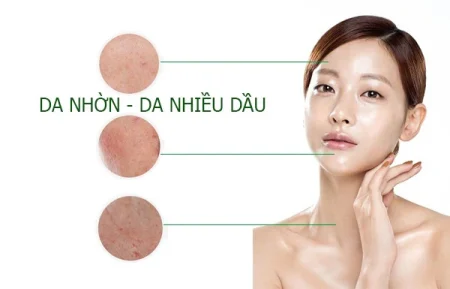 Kiểm soát dầu nhờn