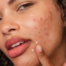 Mesoestetic