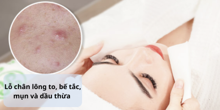Revision Skincare Nectifirm® Advanced